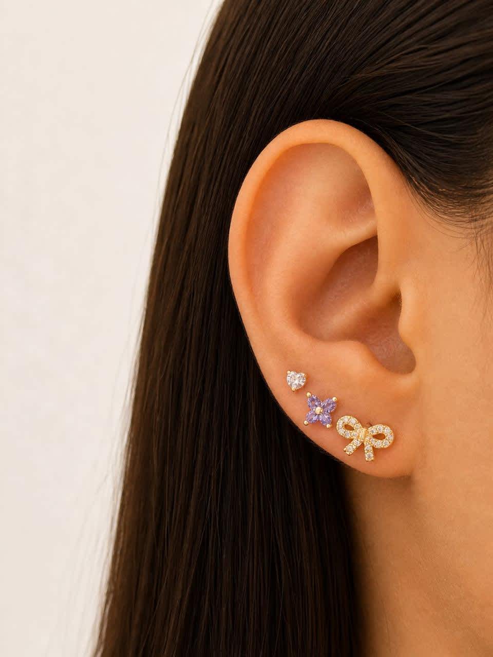 Aretes